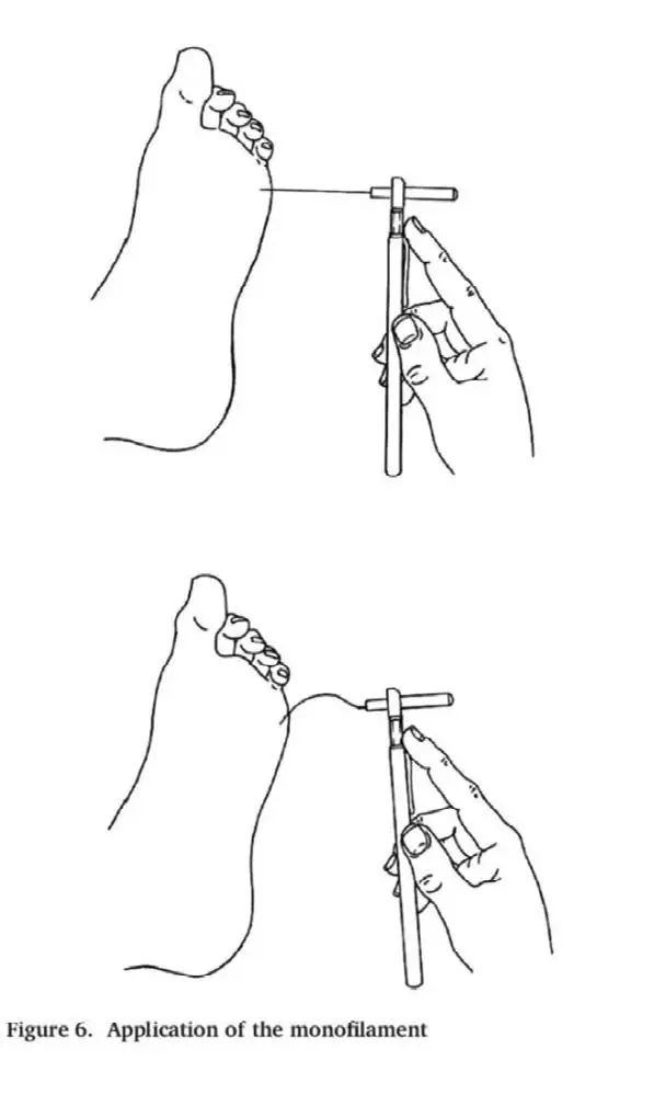 Appendix-12-Monofilament-Application Appendix-12-Monofilament-Application