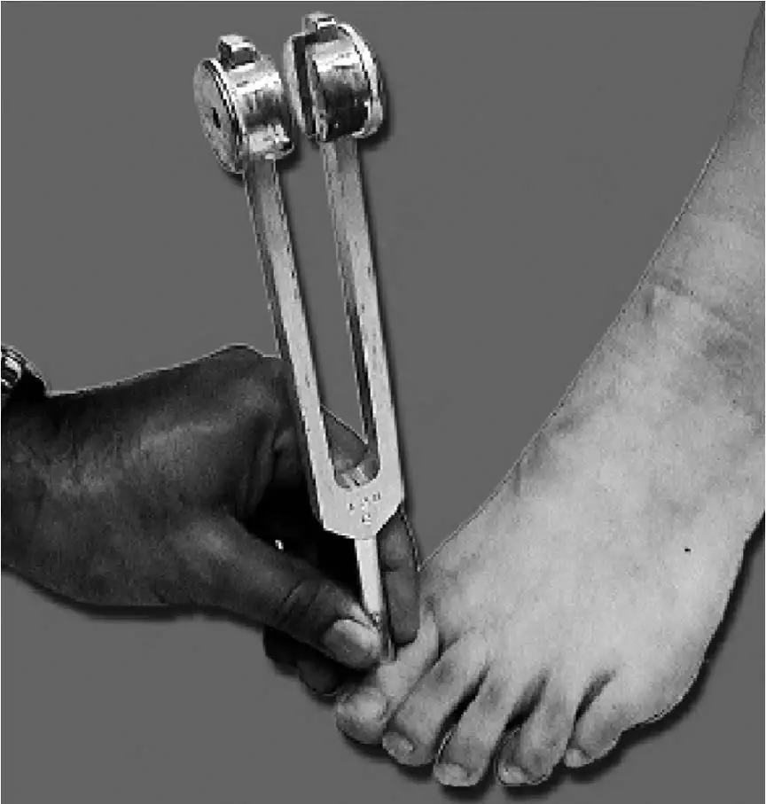 Appendix-11B-Neuropathy-Tuning-Fork
