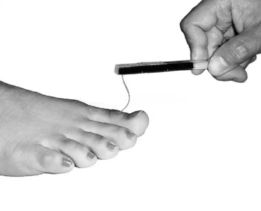 Appendix-11A-Neuropathy-Monofilament
