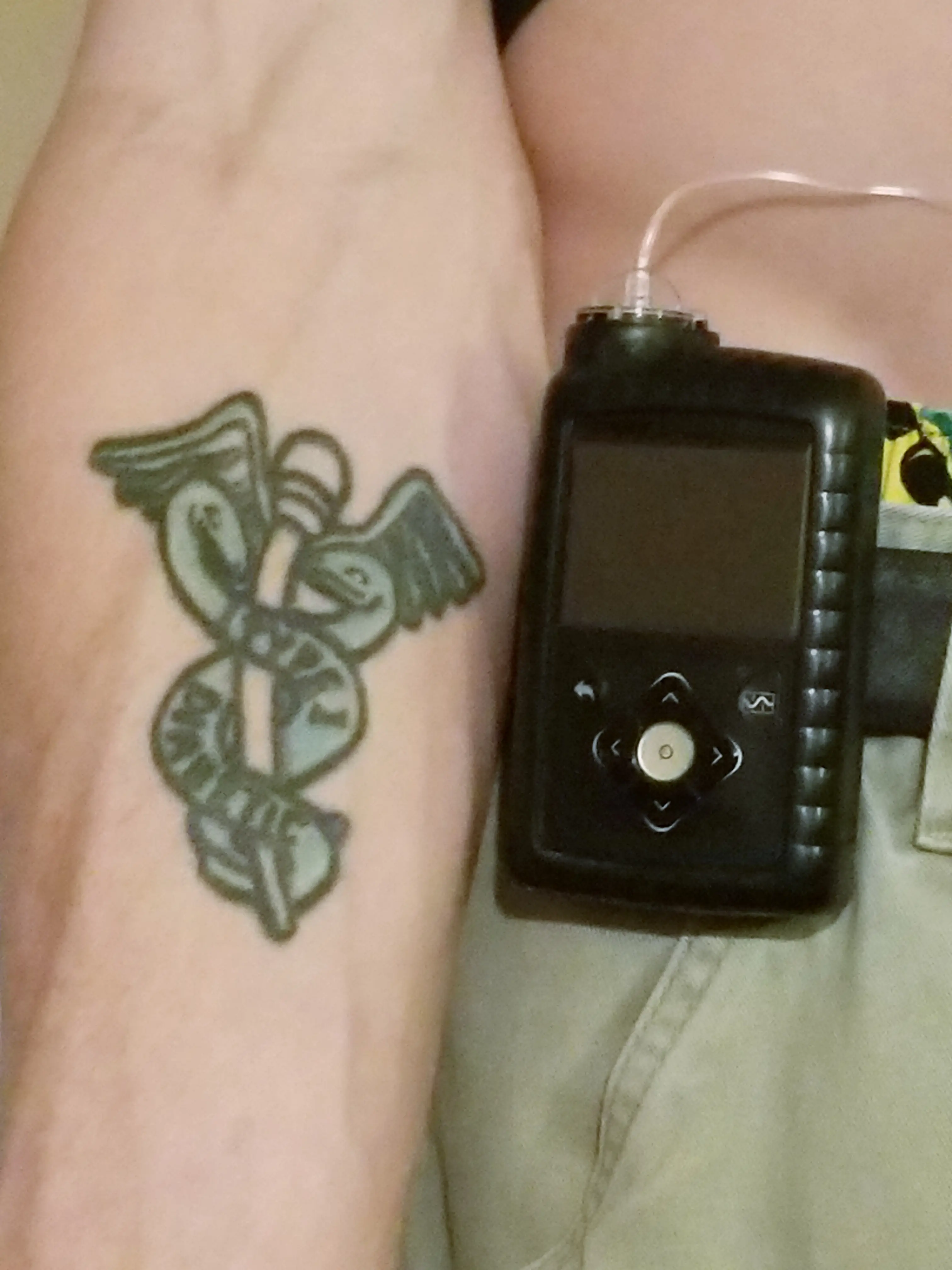 a person's arm with a tattoo and a device